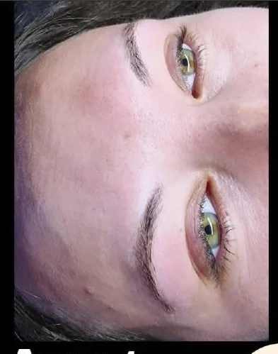 Avant technique mixte sourcils Monnaie - sourcil avant restructuration