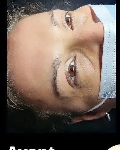 Avant microshading sourcils près de Tours - sourcil clairsemé